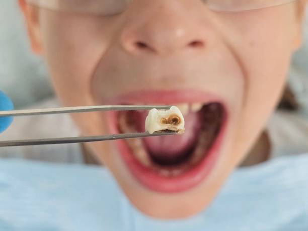 Best Emergency Dentist for Special Needs Patients in Salisbury, NC