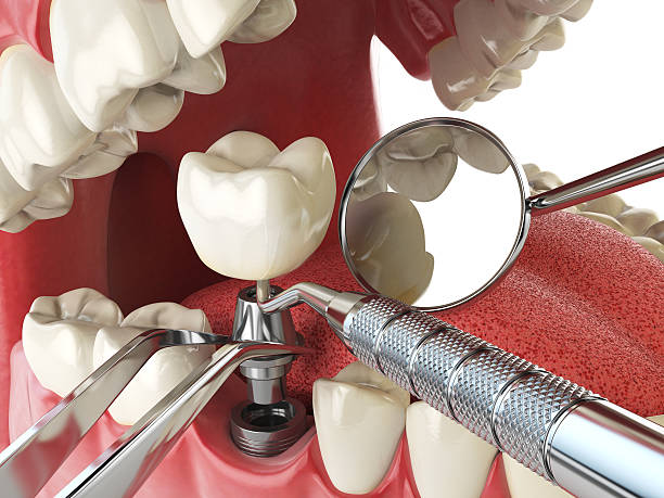 Best Weekend Emergency Dentist in Salisbury, NC