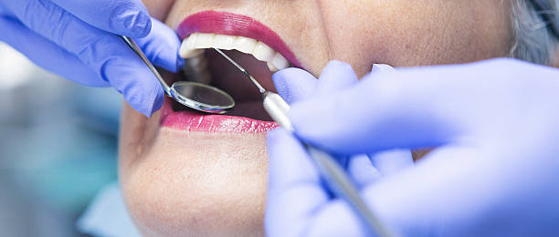 Best Emergency Root Canal Treatment in Salisbury, NC